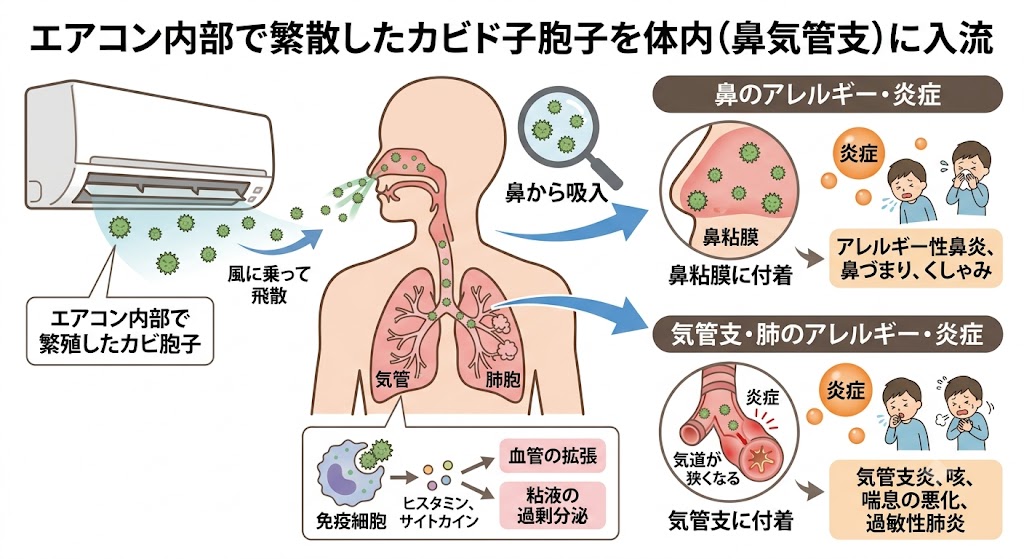 エアコンのカビ胞子が体内に侵入しアレルギーを起こす仕組み
